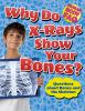 Why_do_x-rays_show_your_bones_